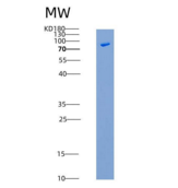 小鼠CDH13 / Cadherin-13 / H Cadh