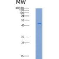 小鼠CD27 / TNFRSF7重组蛋白His & Fc tag