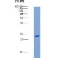 小鼠ASGPR1 / ASGR1重组蛋白His tag