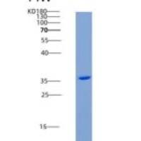 人CNTFR / CNTFR-alpha重组蛋白His tag