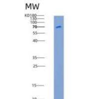 人白三烯A4水解酶(LTA4H)重组蛋白His tag