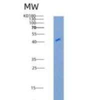 小鼠Frizzled-5/FZD5重组蛋白Fc tag