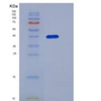 人ACVR2 / ACTRII / ACVR2A重组蛋白Fc tag