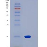 大鼠CD47重组蛋白His tag