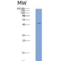 小鼠组织蛋白酶D(CTSD)重组蛋白His Tag