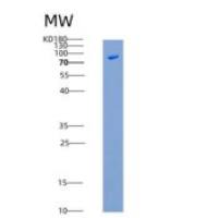 大鼠Cadherin-15 / CDH15重组蛋白Fc tag
