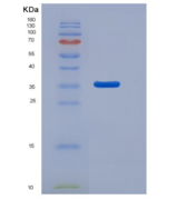 大鼠CD14分子(CD14)重组蛋白His tag