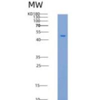 大鼠TrkA / NTRK1重组蛋白His tag
