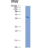 人GFR alpha-2重组蛋白His Tag