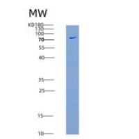 大鼠E-Cadherin / CDH1 / E-cad / CD324重组蛋白His tag