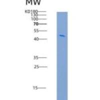 大鼠外异蛋白A受体(EDAR)重组蛋白Fc tag