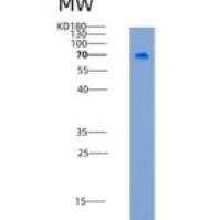 小鼠LILRB3 / LIR3 / ILT5 / CD85a重组蛋白His tag