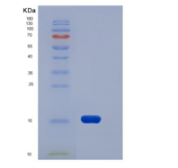人XEDAR / EDA2R重组蛋白His tag