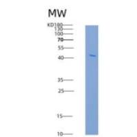 人前列腺酸性磷酸酶/ ACPP重组蛋白His tag