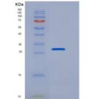小鼠Prostasin / PRSS8重组蛋白aa 30-289, His tag