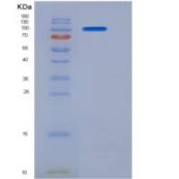 小鼠Siglec-2 / CD22重组蛋白Fc tag