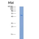 人基质金属蛋白酶7(MMP7)重组蛋白Fc tag