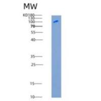大鼠Semaphorin 4D / SEMA4D / CD100重组蛋白Fc tag