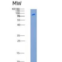 大鼠VE-Cadherin / CD144 / CDH5重组蛋白Fc tag
