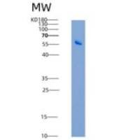 人Galectin-8 / LGALS8重组蛋白GST tag