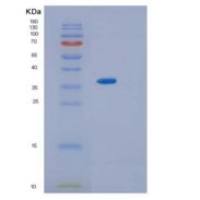 小鼠IL13RA2 / CD213A2重组蛋白His tag