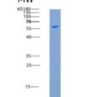 人TPP1 / CLN2重组蛋白His tag