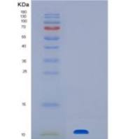 人CLPS / Colipase重组蛋白His tag