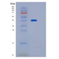 小鼠LAMP2 / CD107b重组蛋白His tag