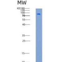 大鼠白血病抑制因子受体(LIFR)重组蛋白His tag