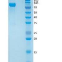 人SLITRK1重组蛋白His tag