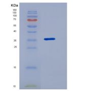 人同线蛋白2(ST2)重组蛋白isoform a, His Tag