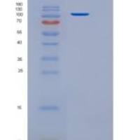 人SorCS1重组蛋白His tag