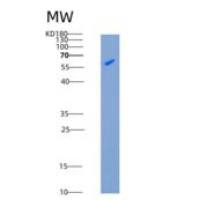 小鼠IL2RG重组蛋白His & Fc tag