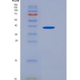 大鼠SIRP alpha / CD172a重组蛋白His tag