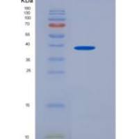 大鼠SIRP alpha / CD172a重组蛋白His tag