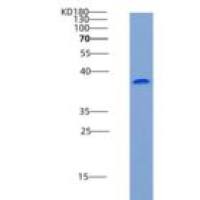 人钙激活核苷酸酶1(CANT1)重组蛋白His tag