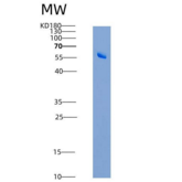 人Galectin-8 / LGALS8重组蛋白GST ta