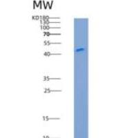 小鼠BACE-1重组蛋白His tag