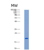 小鼠LY86 / MD-1重组蛋白His tag