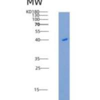 大鼠CD6 / TP120重组蛋白His tag