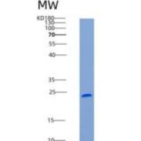 人MBL2 / MBL / COLEC1重组蛋白