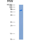 人白介素13受体α1(IL13Ra1)重组蛋白His & F