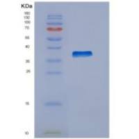 小鼠组织蛋白酶S(CTSS)重组蛋白His Tag