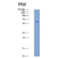 大鼠JAM-2 / JAM-B重组蛋白Fc tag