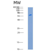 大鼠CADM3 / NECL1 / IGSF4B重组蛋白Fc