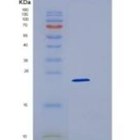 大鼠CD48 / SLAMF2 / BCM1重组蛋白His tag