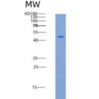 人SerpinA3 / AACT重组蛋白His tag