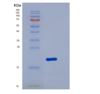 小鼠CD276分子(CD276)重组蛋白His Tag