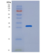 人NUDT5 / ADP-sugar Pyrophospha