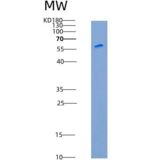 大鼠CADM3 / NECL1 / IGSF4B重组蛋白Fc tag